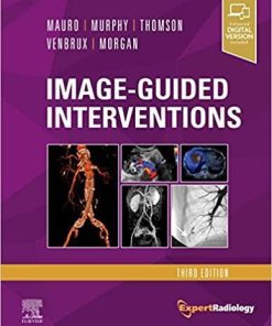 Image-Guided Interventions: Expert Radiology Series 3rd Edition
