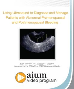 AIUM Using Ultrasound to Diagnose and Manage Patients with Abnormal Premenopausal and Postmenopausal Bleeding (CME VIDEOS)