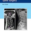 Instrumentation for Minimally Invasive Spine Surgery (PDF)