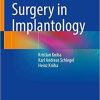 Guided Surgery in Implantology 1st ed. 2021 Edition