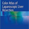 Color Atlas of Laparoscopic Liver Resection 1st ed. 2021 Edition