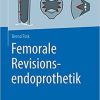 Femorale Revisionsendoprothetik (German Edition) 1. Aufl. 2021 Edition