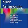 Knee Arthroscopy: How to Succeed 1st ed. 2021 Edition