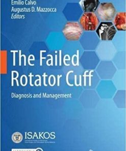 The Failed Rotator Cuff: Diagnosis and Management 1st ed. 2021 Edition