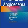 Urticaria and Angioedema 2nd ed. 2021 Edition