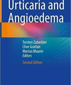 Urticaria and Angioedema 2nd ed. 2021 Edition