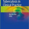 Tuberculosis in Clinical Practice 1st ed. 2021 Edition
