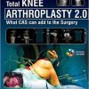 Total Knee Arthroplasty 2.0: What CAS can add to the Surgery 1st Edition