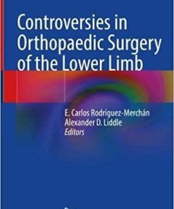 Controversies in Orthopaedic Surgery of the Lower Limb 1st ed. 2021 Edition