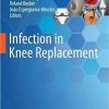 Infection in Knee Replacement 1st ed. 2022 Edition