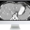 SAR Disease-Focused Panels: Cancer Imaging and Reporting Guidelines 2021