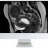 ARRS Abdominal MRI: Practical Applications and Advanced Imaging Techniques 2021