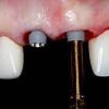 Online Residency Program: A-Z in Implant Dentistry 2021