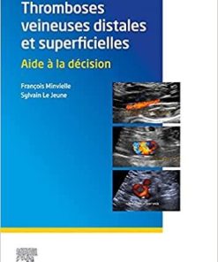 Thromboses veineuses distales et superficielles: Aide à la décision (French Edition)