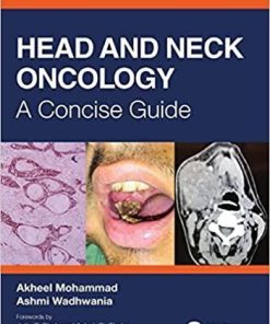 Head and Neck Oncology: A Concise Guide 1st Edition