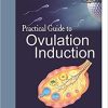 Practical Guide to Ovulation Induction