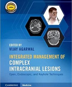 Integrated Management of Complex Intracranial Lesions Hardback Set and Static Online Product: Open, Endoscopic, and Keyhole Techniques New Edition