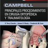 Campbell. Principales procedimientos en cirugía ortopédica y traumatología (Spanish Edition) 1st Edition