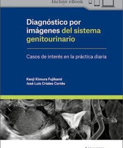 Diagnóstico por Imágenes del Sistema Genitourinario. Casos de Interés en la Práctica Diaria