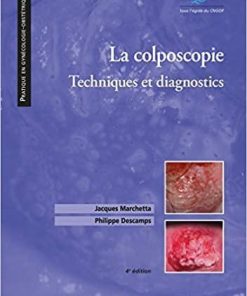 La colposcopie: Techniques et diagnostics