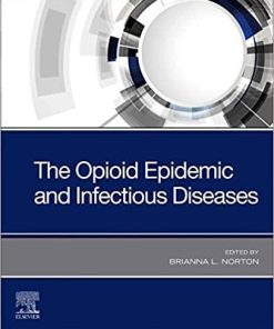 The Opioid Epidemic and Infectious Diseases 1st Edition