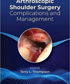 Complications of Arthroscopic Surgery 1st Edition