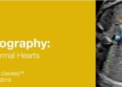 2019 Fetal Echocardiography: Normal and Abnormal Hearts (CME Videos)
