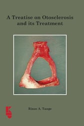 A Treatise on Otoslerosis and its Treatment (EPUB)