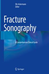 Fracture Sonography (PDF)