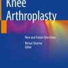Knee Arthroplasty : New and Future Directions (PDF Book)