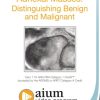 AIUM Adnexal Masses: Distinguishing Benign and Malignant (CME VIDEOS)