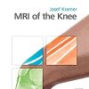 MRI of the Knee, 1st edition (PDF)