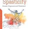 Spasticity: Causes, Diagnosis and Treatment (PDF)