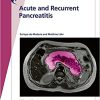 Fast Facts: Acute and Recurrent Pancreatitis: Using evidence to support treatment (PDF)