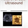 Atlas of breast ultrasound (PDF)