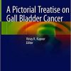 A Pictorial Treatise on Gall Bladder Cancer (PDF)