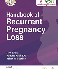 Handbook Of Recurrent Pregnancy Loss (PDF)