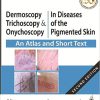 Dermoscopy, Trichoscopy & Onychoscopy In Diseases of the Pigmented Skin An Atlas and Short Text (PDF)