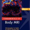 Fundamentals of Body MRI, 2nd Edition (Fundamentals of Radiology) (Retail PDF)