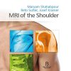 MRI of the Shoulder (PDF)