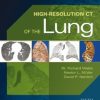 High-Resolution CT of the Lung, 5th Edition (PDF)