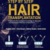 Step by Step Hair Transplantation (PDF)