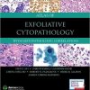 Atlas of Exfoliative Cytopathology: With Histopathologic Correlations (EPUB)