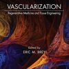 Vascularization: Regenerative Medicine and Tissue Engineering