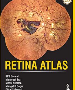Retina Atlas (PDF)
