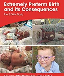 Extremely Preterm Birth and its Consequences: The ELGAN Study (Clinics in Developmental Medicine) (PDF)