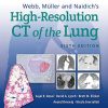 Webb, Müller and Naidich’s High-Resolution CT of the Lung, 6ed (ePub+azw3+Converted PDF)