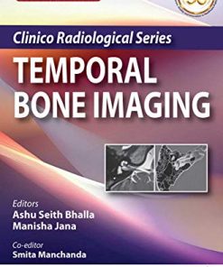 Clinico Radiological Series: Temporal Bone Imaging, 2nd edition (azw3+ePub+Converted PDF)