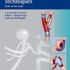 Neurointerventional Techniques: Tricks of the Trade (PDF)
