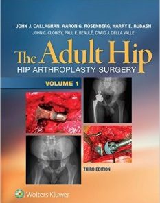 The Adult Hip (Two Volume Set): Hip Arthroplasty Surgery, Third Edition (EPUB)